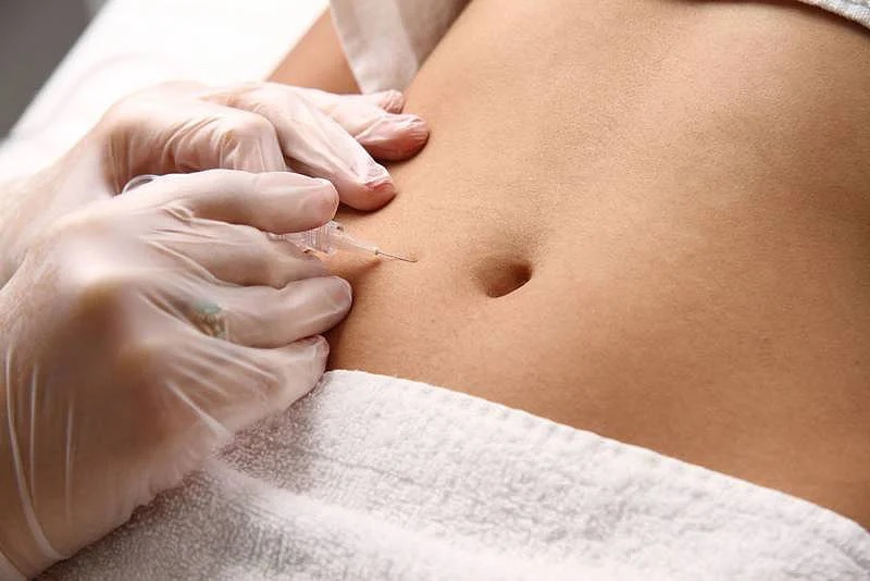Carboxiterapia para Celulitis