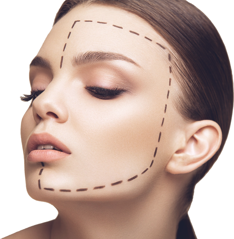 Hilos Faciales
